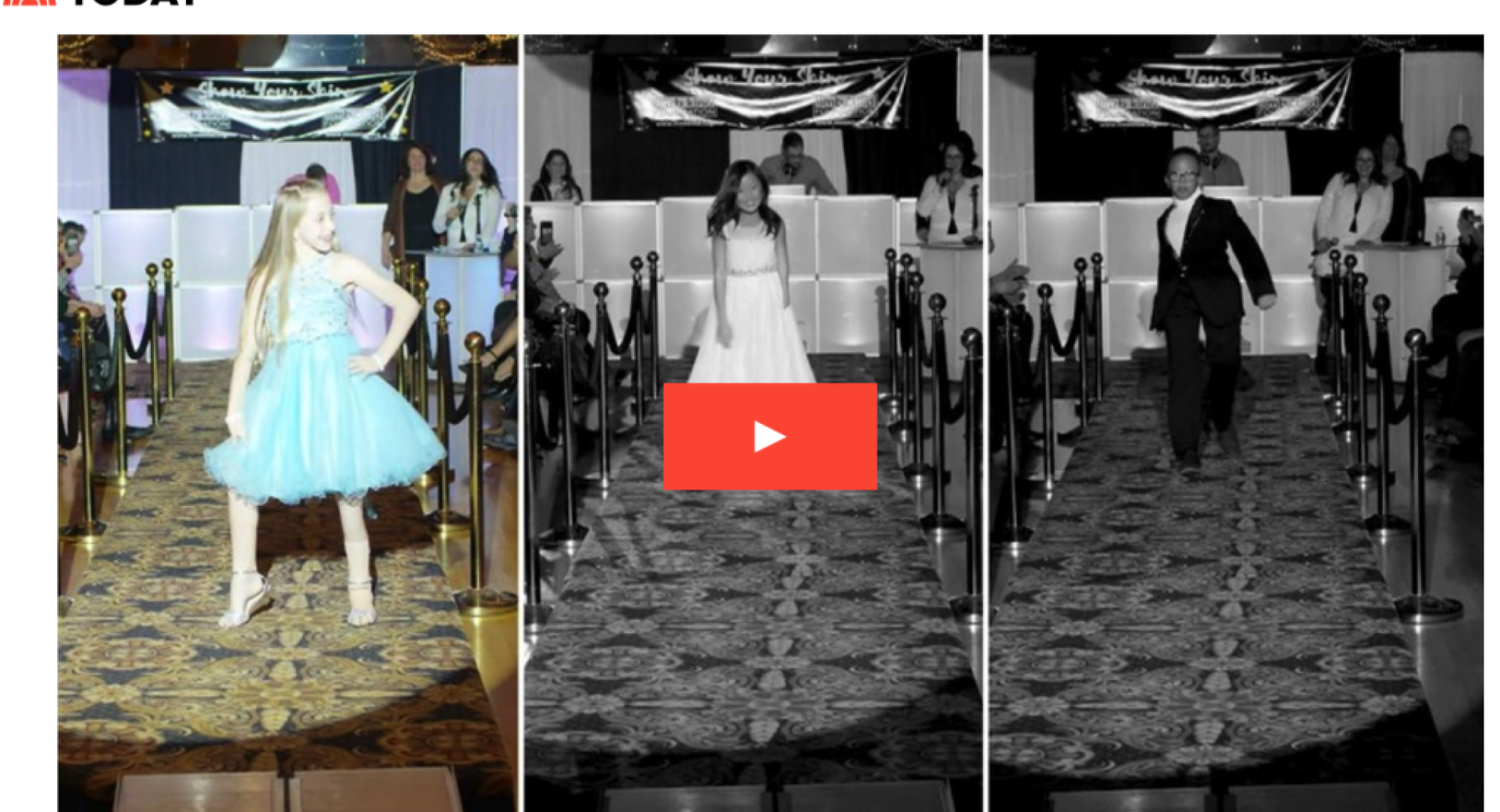 25 kids with limb loss shine in inspiring fashion show